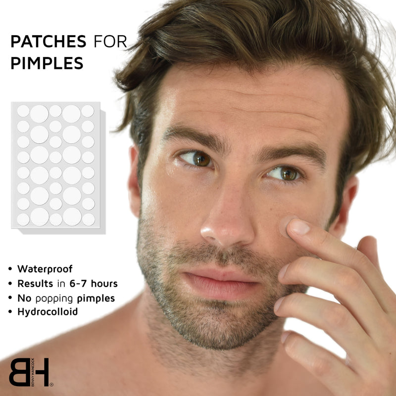 PATCHES FOR PIMPLES